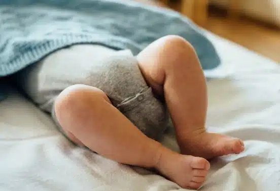 newborn circumcision infant circumcision infant constipation