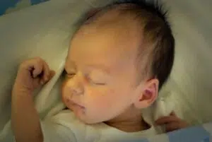 Hydrocephalus: Understanding the "Water on the Brain" Condition in Children 3 Hydrocephalus
