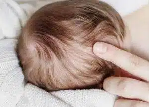 newborn-baby-without-hair
