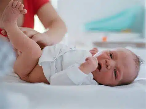 baby's-circumcision-Infant-Circumcision-newborn-Circumcision