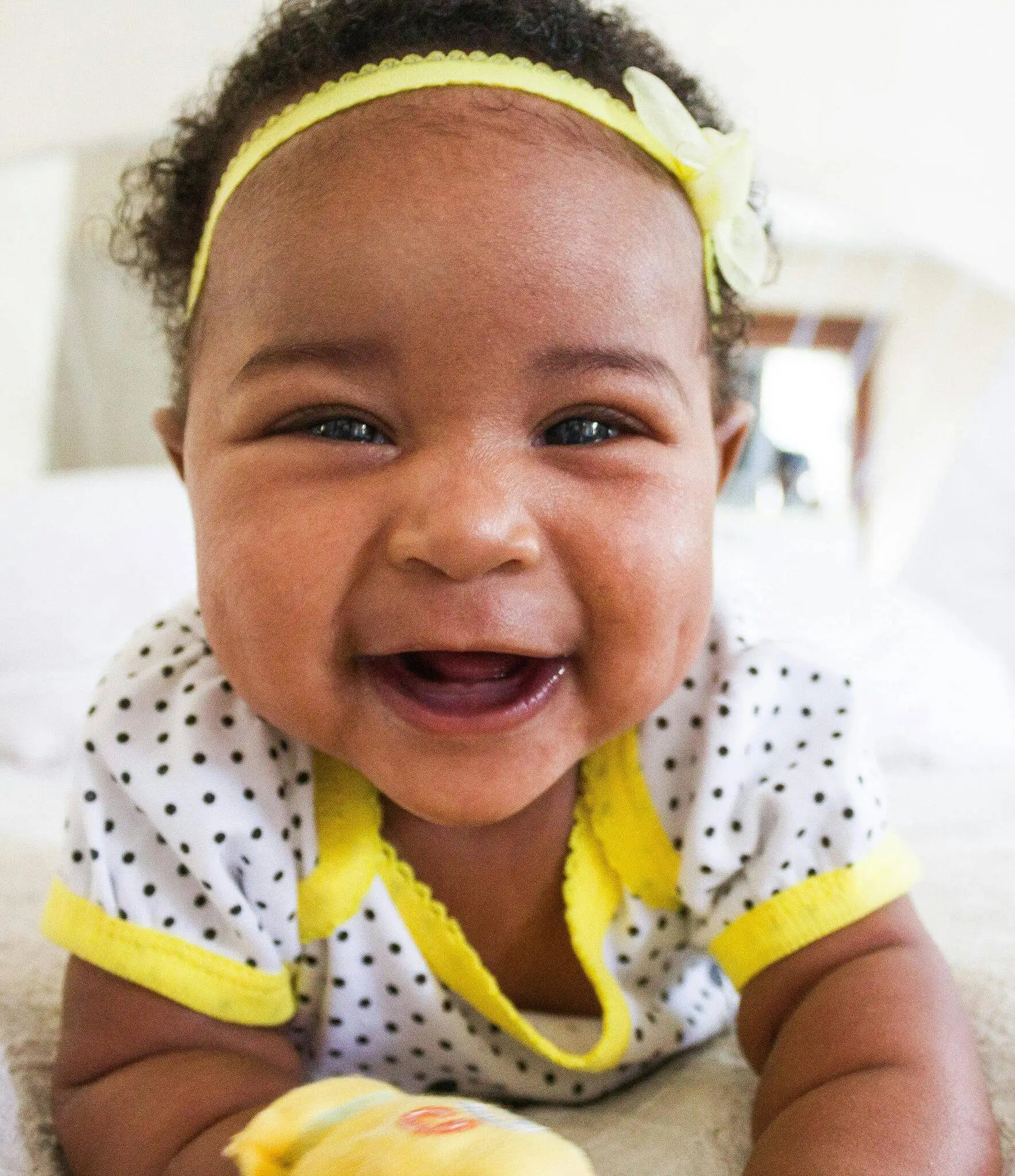 newborn baby hair fall out