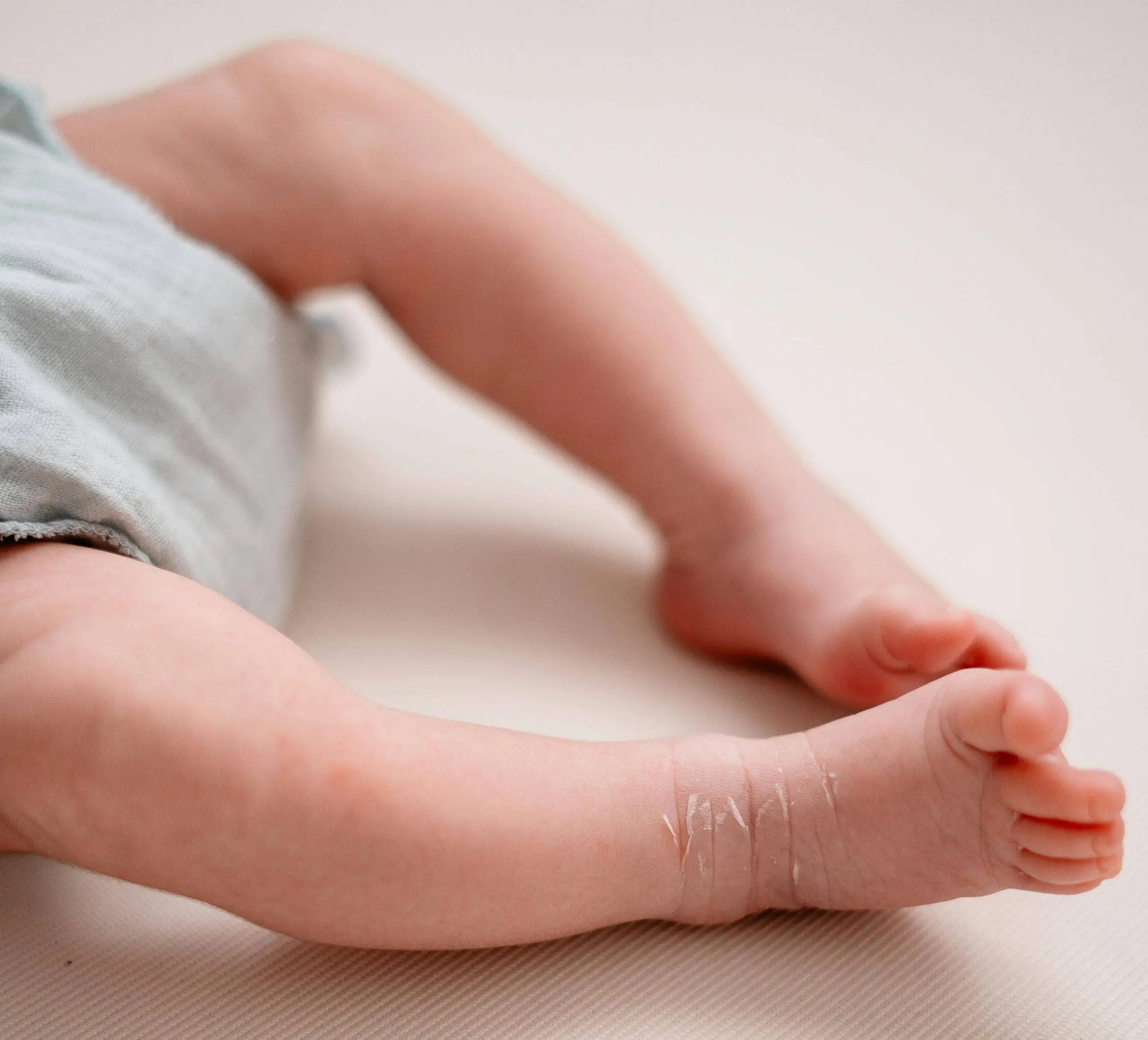 What To Do for Newborn Baby Heat Rash: 9 Expert Tips for Soothe and Prevention 3 What To Do for Newborn Baby Heat Rash: 9 Expert Tips for Soothe and Prevention