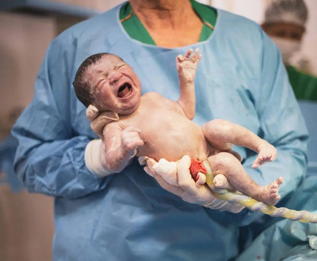 Zygote: The First Miraculous Step in Your Child's Development 2 newborn health